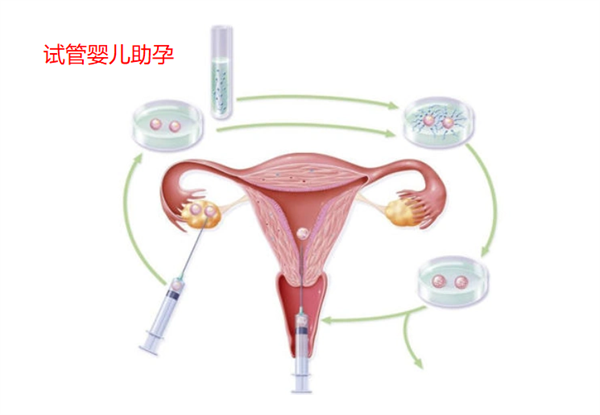 17447174413269.png 17447174413269.png