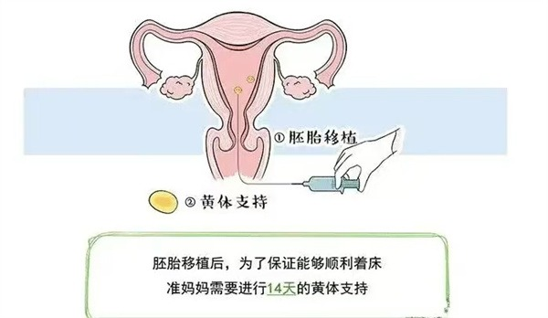 17447949079098.png wps48.png