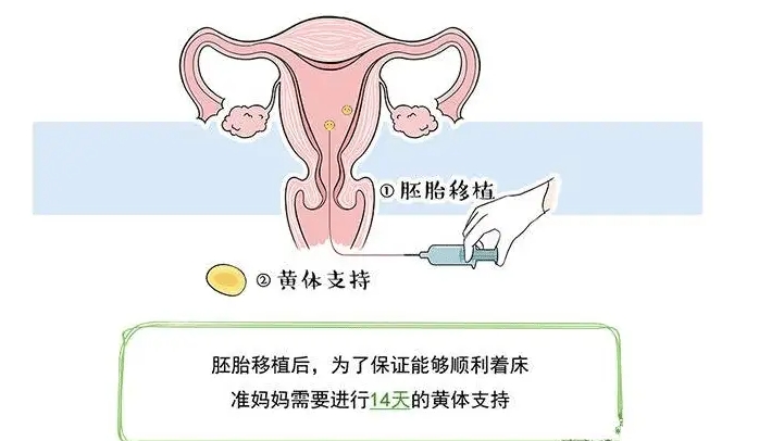 17447955986729.jpg wps55.jpg