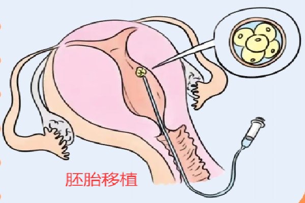 17453999909885.png 微信图片_20250423170510.png