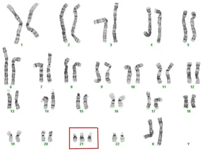 17456464037628.jpg u=414266994,3551325258&fm=253&fmt=auto&app=138&f=JPEG.webp.jpg