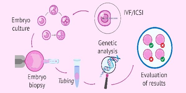 单身人士为什么会选择去吉尔吉斯斯坦做三代试管婴儿?